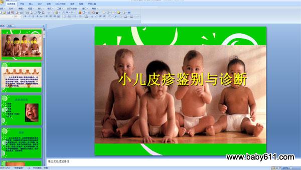 小儿皮疹鉴别与诊断 ppt课件