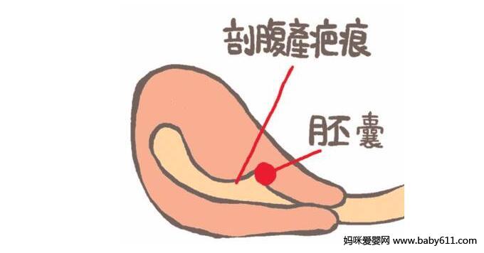 大龄如何备孕 大龄备孕的4个重要指标